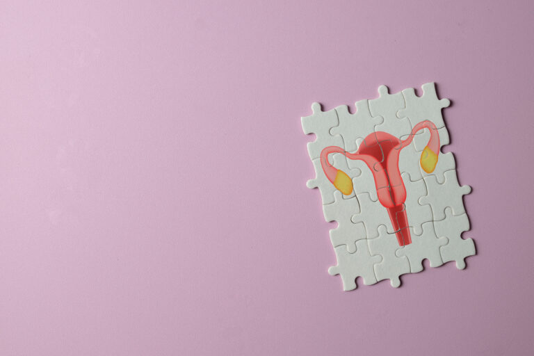 How Is PCOS/PMOS Diagnosed? What to Expect When Getting Tested